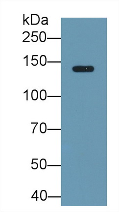 Monoclonal Antibody to Ceruloplasmin (CP)