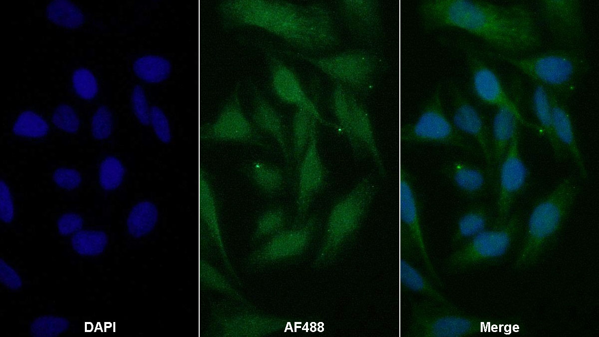 Monoclonal Antibody to Ceruloplasmin (CP)