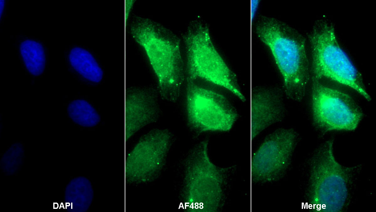 Monoclonal Antibody to Ceruloplasmin (CP)