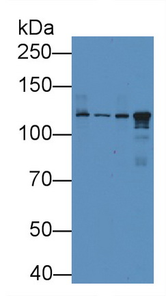 Monoclonal Antibody to Ceruloplasmin (CP)