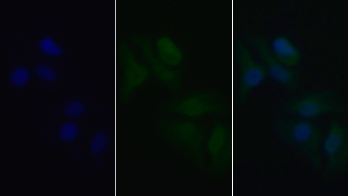 Monoclonal Antibody to Tumor Protein p53 (P53)