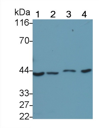 Monoclonal Antibody to Tumor Protein p53 (P53)