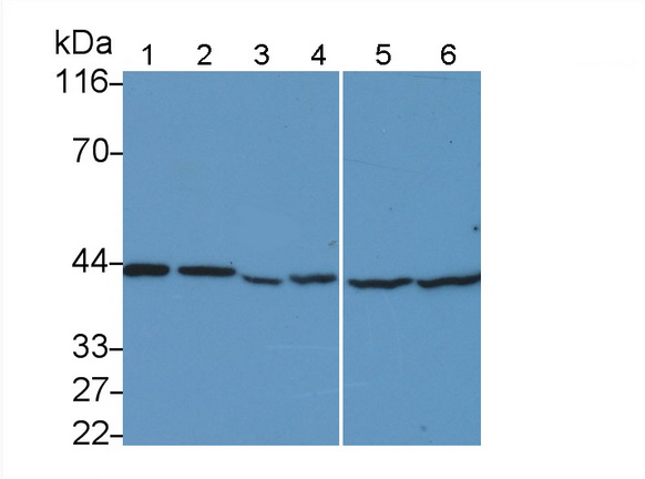 Monoclonal Antibody to Tumor Protein p53 (P53)