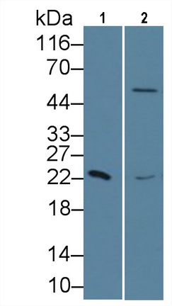 Monoclonal Antibody to Retinol Binding Protein 4 (RBP4)