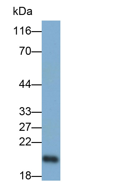 Monoclonal Antibody to Retinol Binding Protein 4 (RBP4)