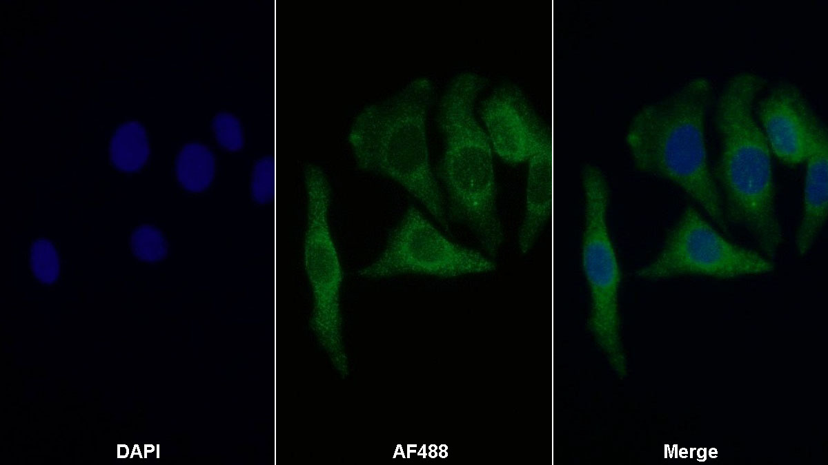 Monoclonal Antibody to Retinol Binding Protein 4 (RBP4)