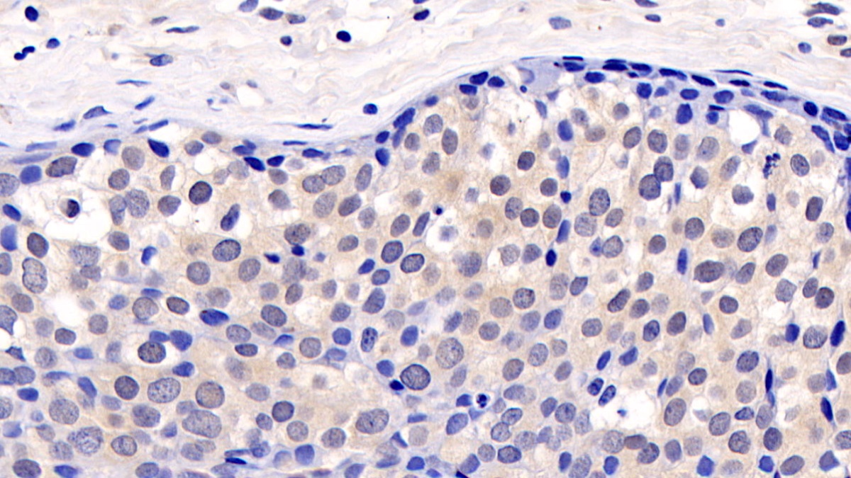 Monoclonal Antibody to Extracellular Signal Regulated Kinase 2 (ERK2)