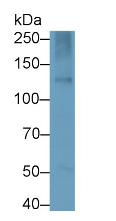 Monoclonal Antibody to Nephrin (NPHN)