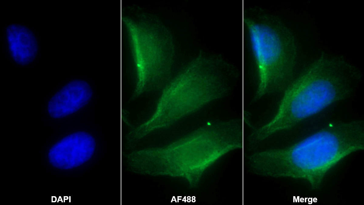 Monoclonal Antibody to Nephrin (NPHN)