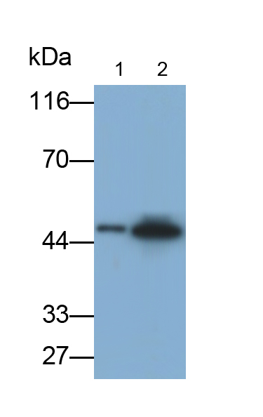 Monoclonal Antibody to Chemokine C-X-C-Motif Receptor 4 (CXCR4)