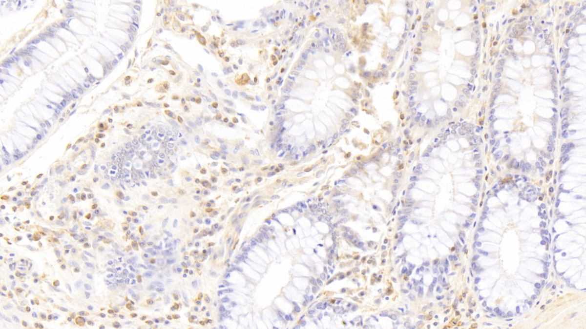 Monoclonal Antibody to Neutrophil Specific Antigen 1 (NB1)