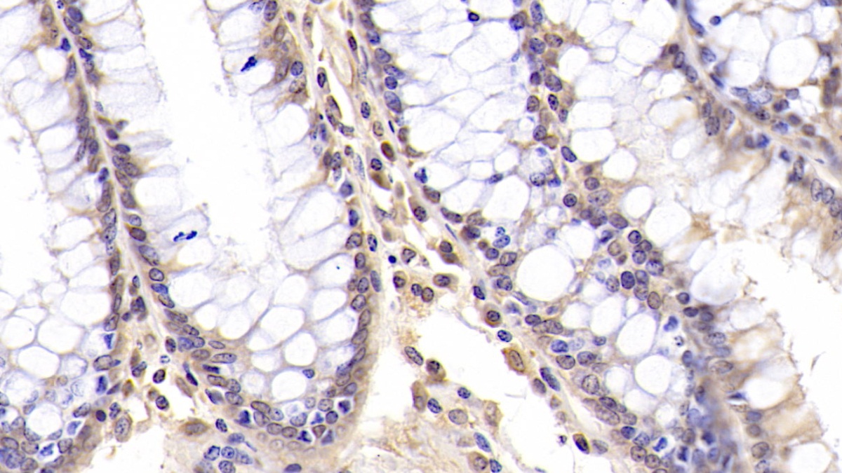 Monoclonal Antibody to Neutrophil Specific Antigen 1 (NB1)