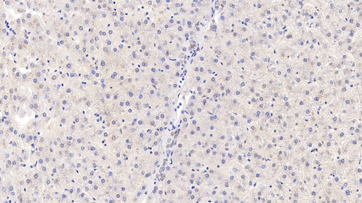 Monoclonal Antibody to Chemerin (CHEM)