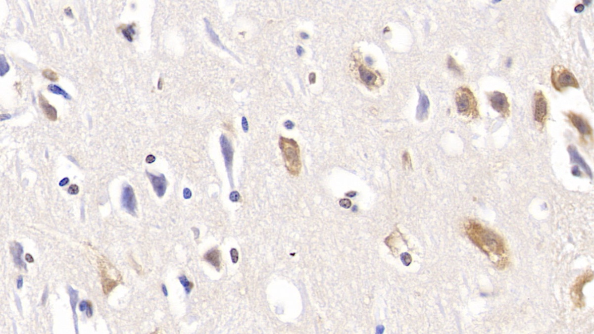 Monoclonal Antibody to Chemerin (CHEM)