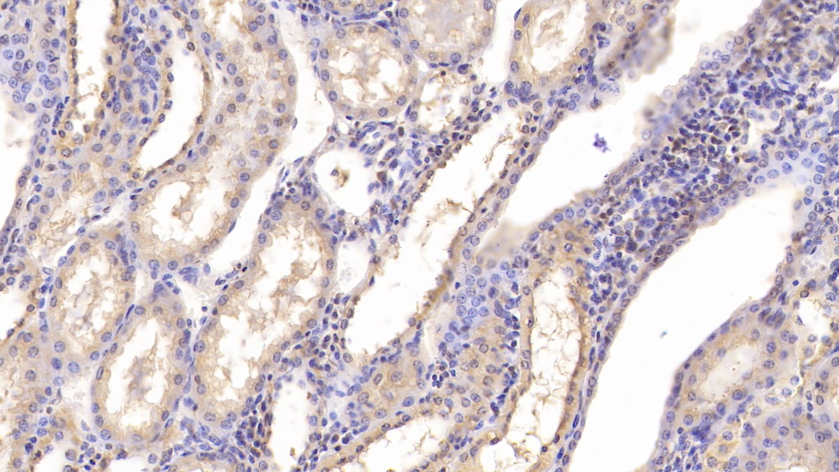 Monoclonal Antibody to Chemerin (CHEM)