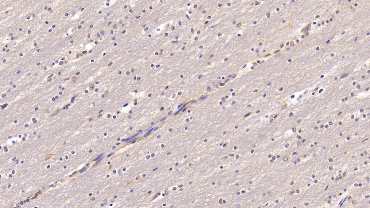 Monoclonal Antibody to Chemerin (CHEM)