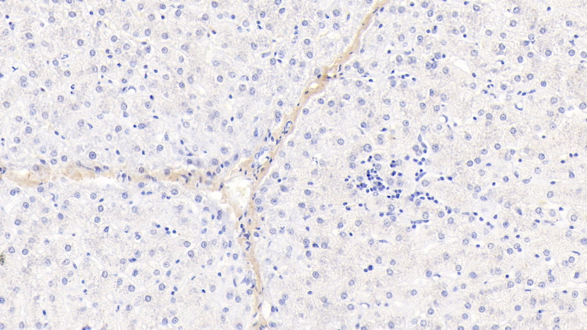 Monoclonal Antibody to Procollagen I N-Terminal Propeptide (PINP)