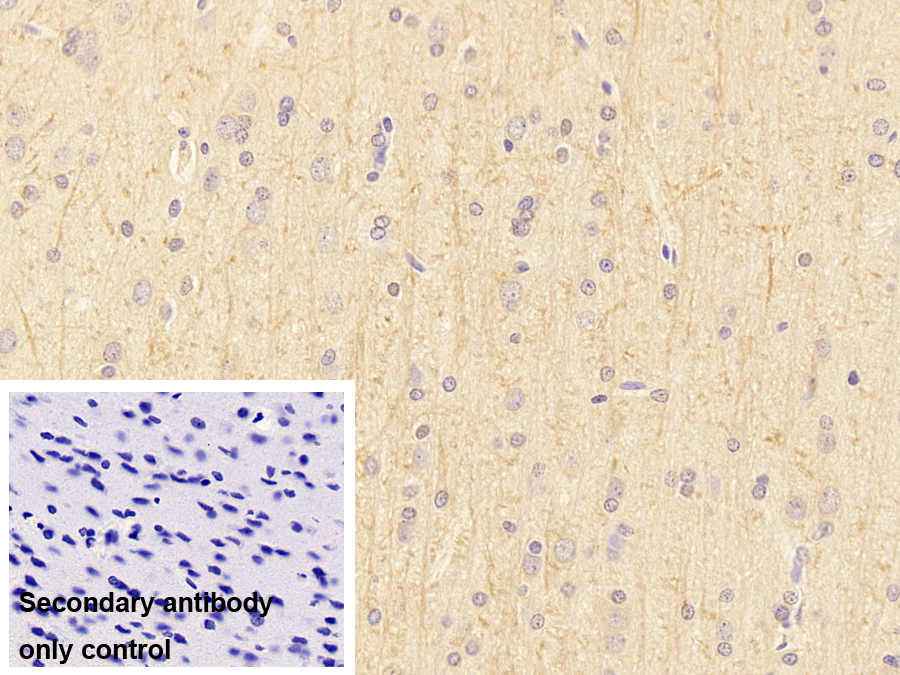 Monoclonal Antibody to L1-Cell Adhesion Molecule (L1CAM)