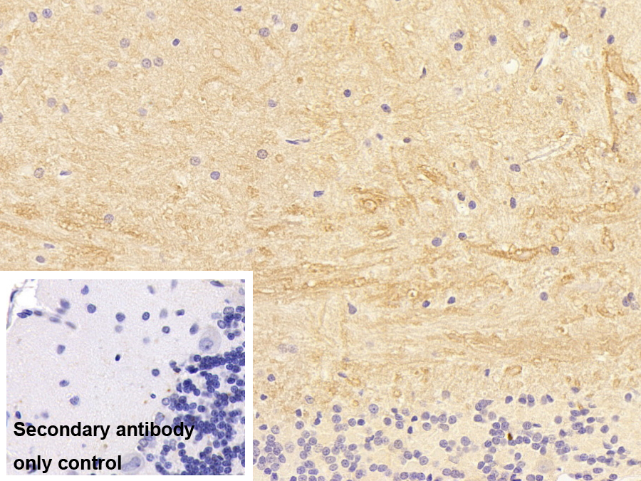 Monoclonal Antibody to L1-Cell Adhesion Molecule (L1CAM)