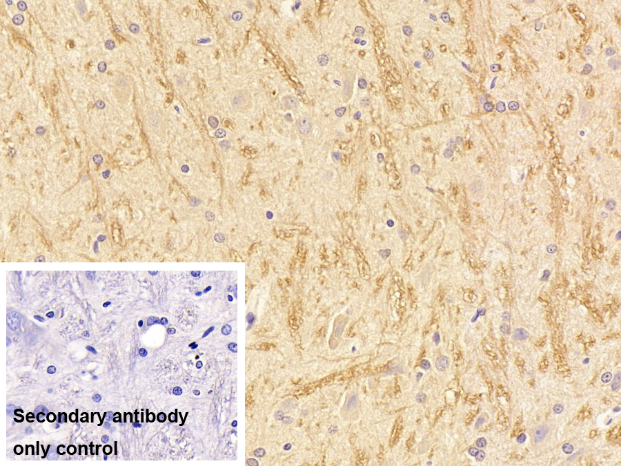 Monoclonal Antibody to L1-Cell Adhesion Molecule (L1CAM)