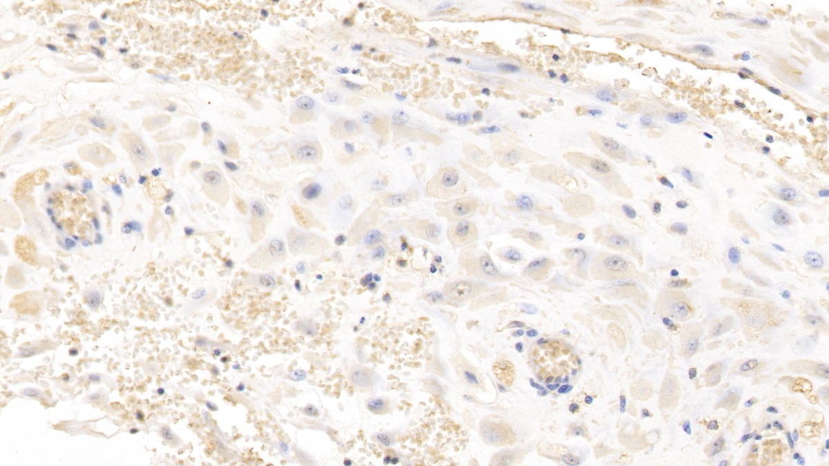 Monoclonal Antibody to Glypican 3 (GPC3)