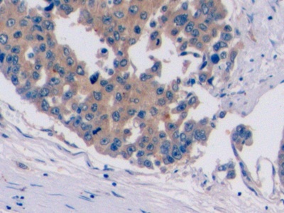 Monoclonal Antibody to Glypican 3 (GPC3)