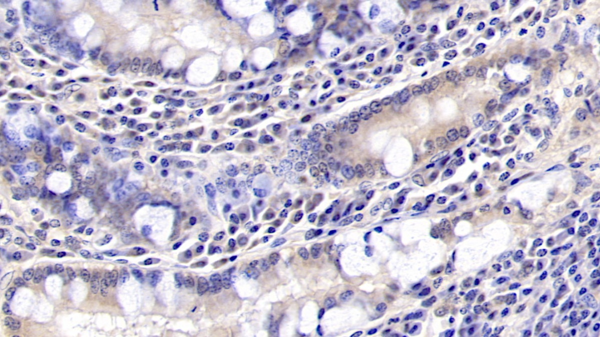 Monoclonal Antibody to Glypican 3 (GPC3)