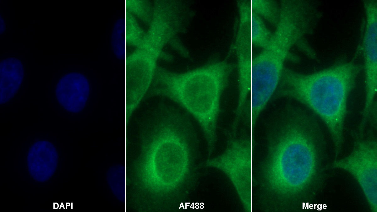 Monoclonal Antibody to Cyclophilin A (CYPA)