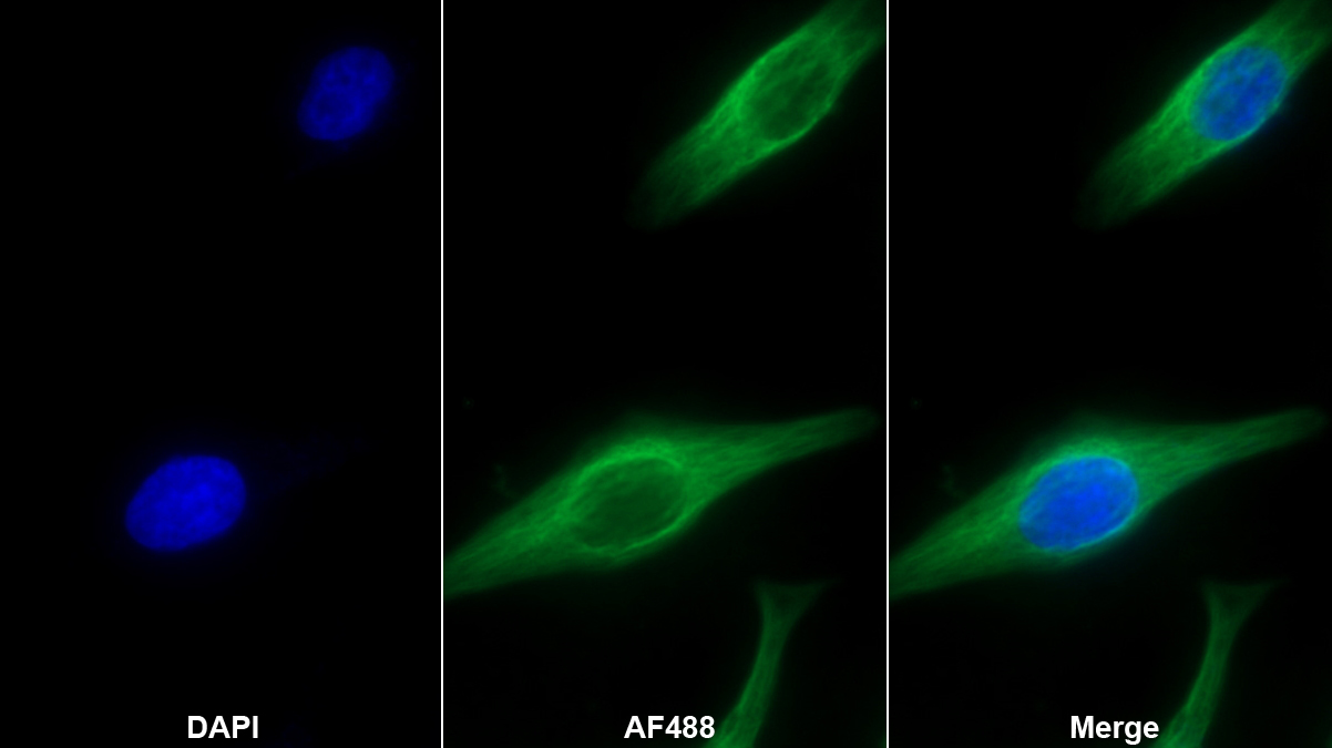 Monoclonal Antibody to Alpha-2-Macroglobulin (a2M)