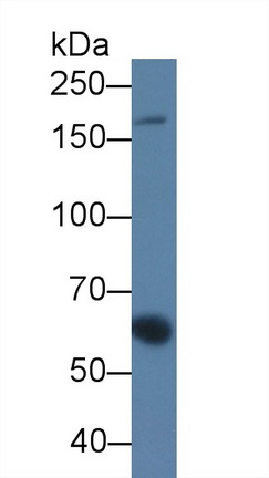 Monoclonal Antibody to Alpha-2-Macroglobulin (a2M)