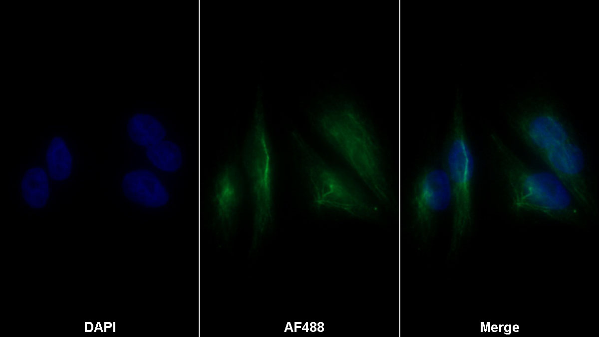 Monoclonal Antibody to Alpha-Lactalbumin (aLA)