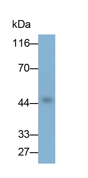 Monoclonal Antibody to Angiopoietin Like Protein 4 (ANGPTL4)