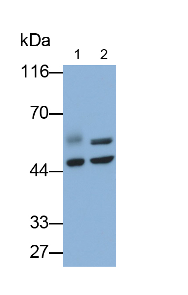 Monoclonal Antibody to Angiopoietin Like Protein 4 (ANGPTL4)