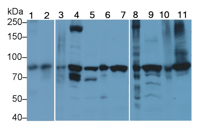 Monoclonal Antibody to Beta Catenin (β-catenin)