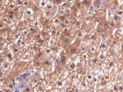 Monoclonal Antibody to Beta Catenin (β-catenin)