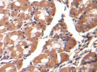 Monoclonal Antibody to Beta Catenin (β-catenin)