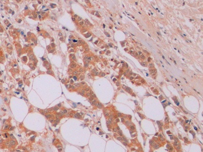 Monoclonal Antibody to Beta Catenin (β-catenin)