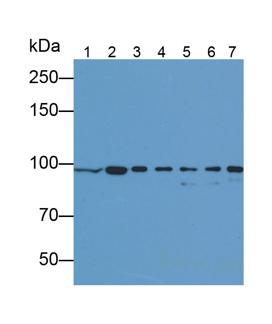 Monoclonal Antibody to Beta Catenin (β-catenin)