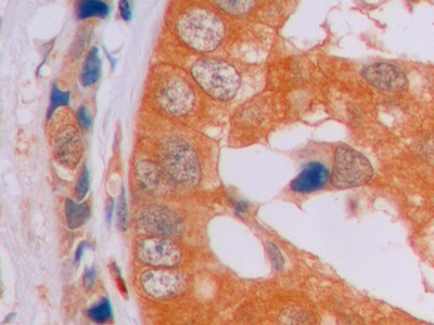 Monoclonal Antibody to Beta Catenin (β-catenin)