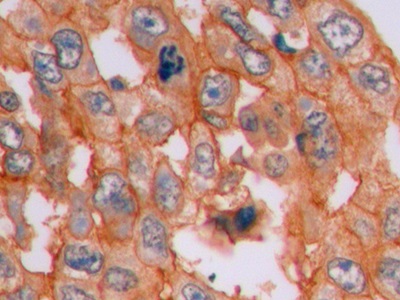 Monoclonal Antibody to Beta Catenin (β-catenin)