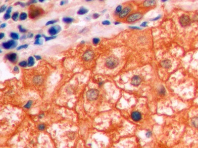 Monoclonal Antibody to Beta Catenin (β-catenin)