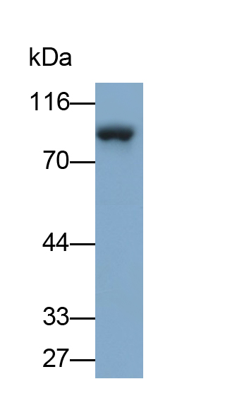 Monoclonal Antibody to Beta Catenin (β-catenin)