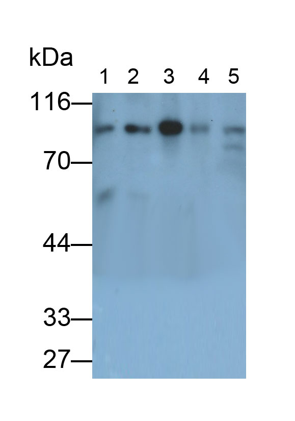 Monoclonal Antibody to Beta Catenin (β-catenin)