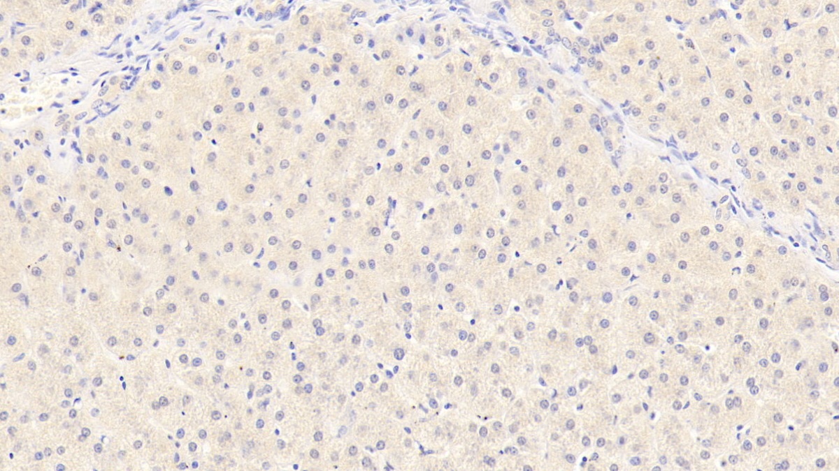 Monoclonal Antibody to Albumin (ALB)