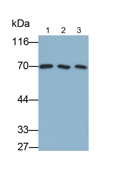 Monoclonal Antibody to Albumin (ALB)