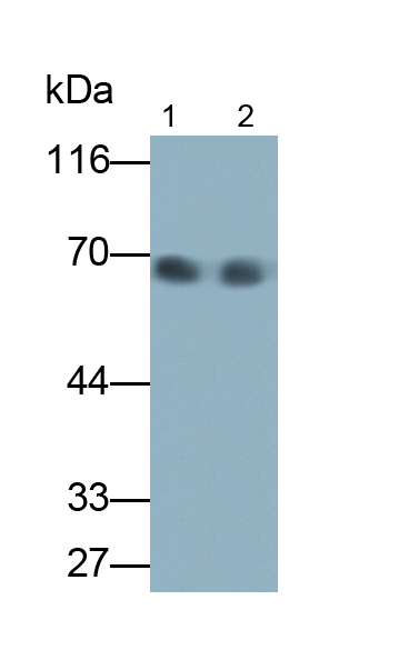 Monoclonal Antibody to Albumin (ALB)