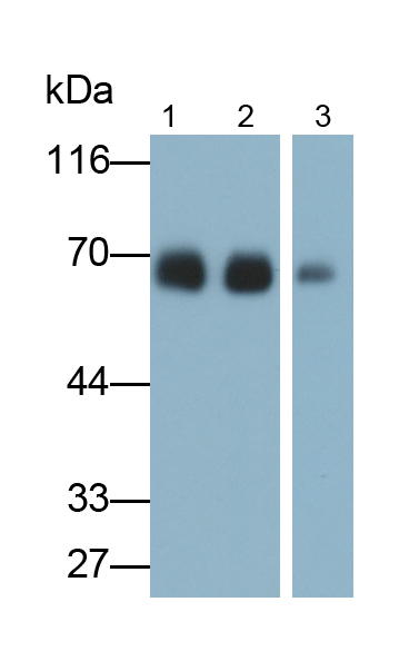 Monoclonal Antibody to Albumin (ALB)