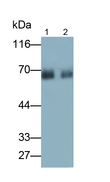 Monoclonal Antibody to Albumin (ALB)