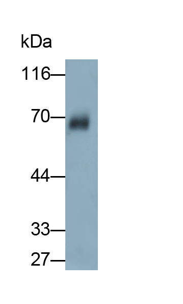 Monoclonal Antibody to Albumin (ALB)