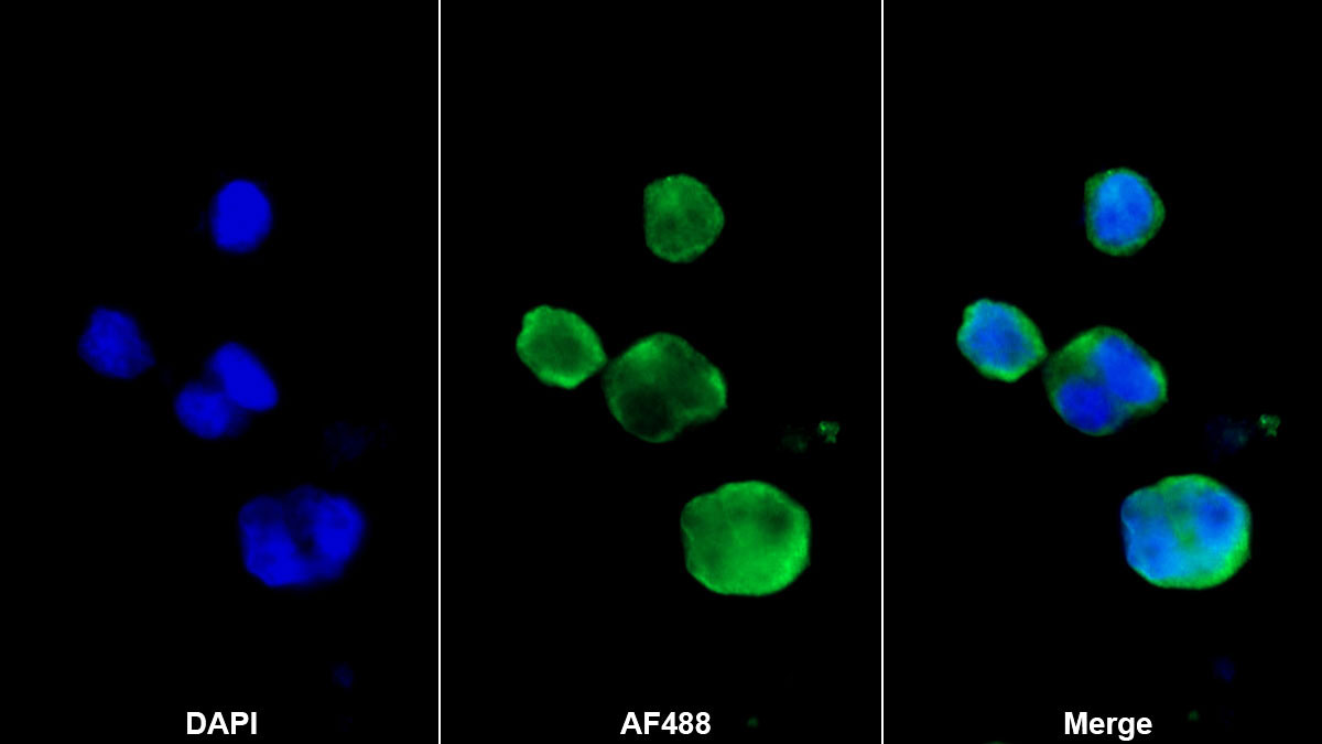 Monoclonal Antibody to Integrin Alpha 2B (ITGa2B)